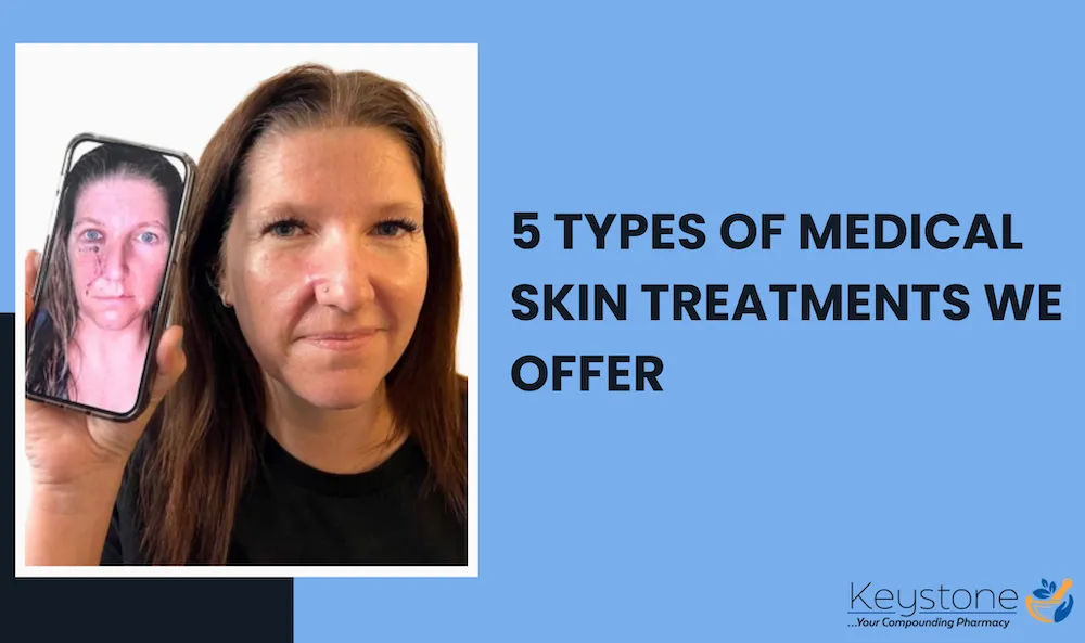 5 Types of Medical Skin Treatments We Offer