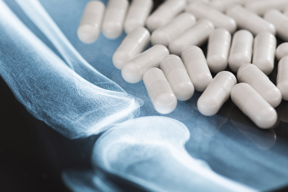 5 of the Best Supplements for Joints That We Offer